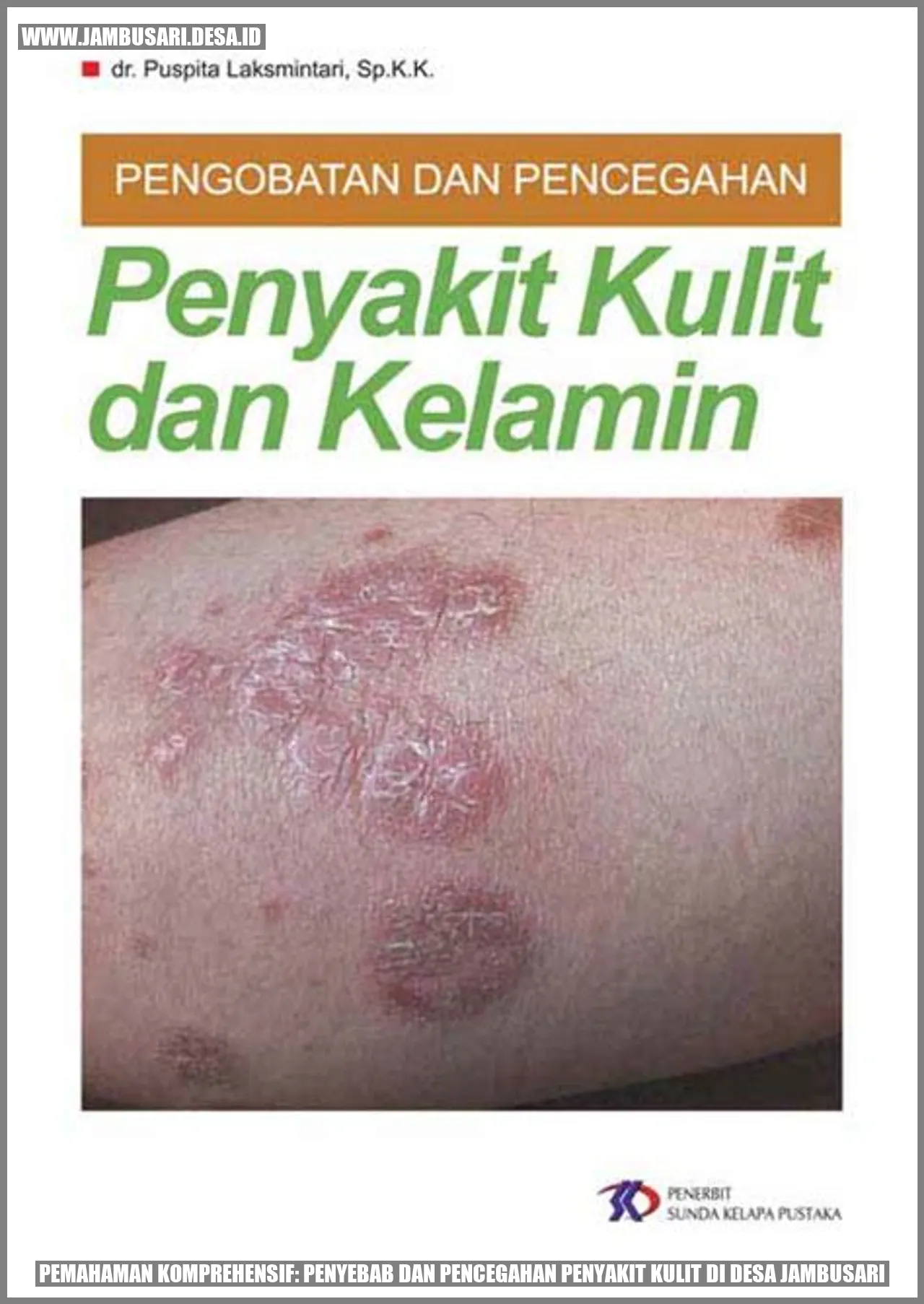 Gambar penyakit kulit